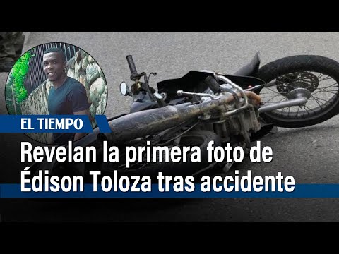 Revelan la primera foto del exfutbolista Édison Toloza tras grave accidente en moto | El Tiempo