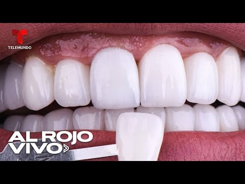 Alertan por dentistas falsos que ofrecen carillas y trabajos dentales en redes sociales