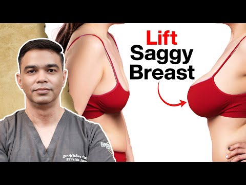 How to lift saggy breasts Breast life with implant