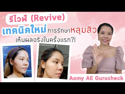 (เช็คสูตร)-รีไวฟ์-(Revive)-เทค (เช็คสูตร)-รีไวฟ์-(Revive)-เทค