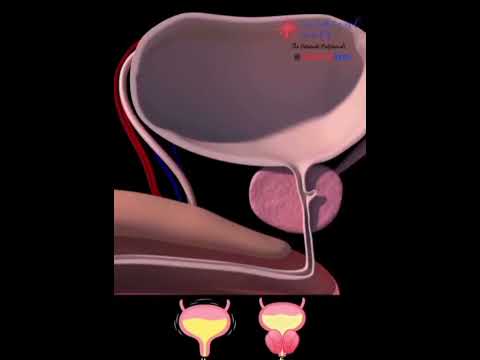 undar#prosesar#vidios#mesan#3d#trending#song#youtube #vidios#vidioviral #human#body#parts#gk ...