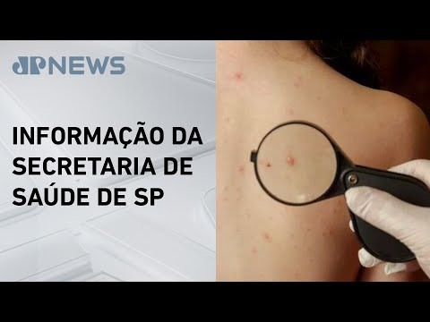 Homem com suspeita de Mpox testa positivo para catapora