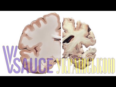 Хвороба Альцгеймера та мозок - Vsauce українською