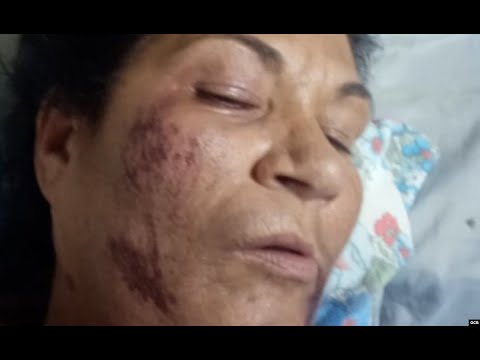 Info Martí | Madre de preso político se recupera de asalto y golpiza en la vía pública