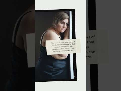 Is lipedema is common in Singaporeans?