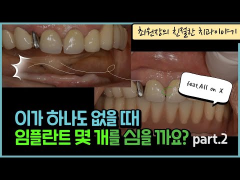 올온4  아래턱 뼈가 <strong>부족한경우</strong> 뼈이식없이 임플란트를 수복하는 방법