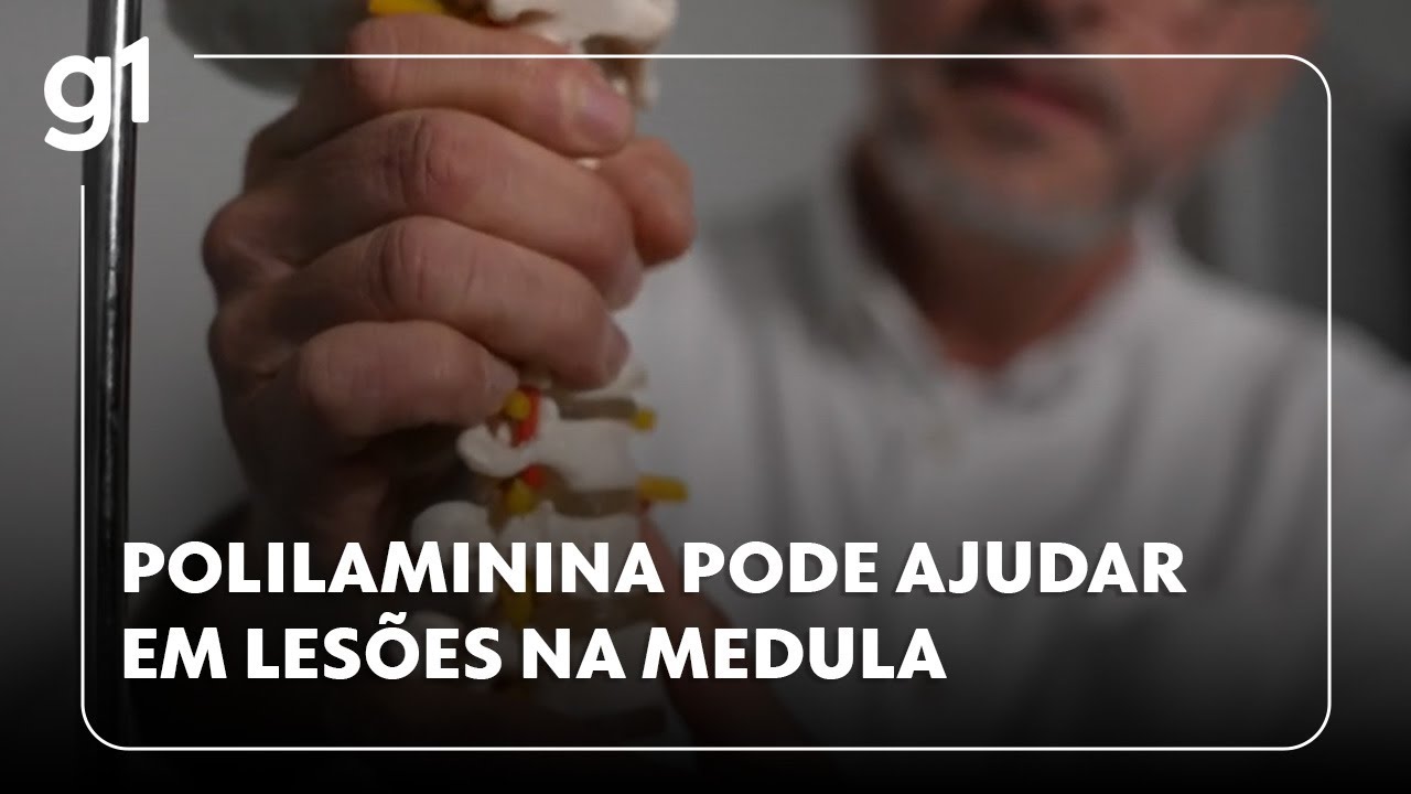 Polilaminina pode ajudar em lesões na medula