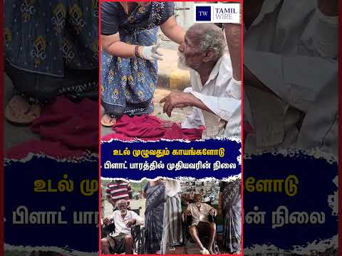 உடல் முழுவதும் காயங்களோடு பிளாட் பாரத்தில் முதியவரின் நிலை #Visag #visagapattinam #Oldman #<strong>Platform</strong>
