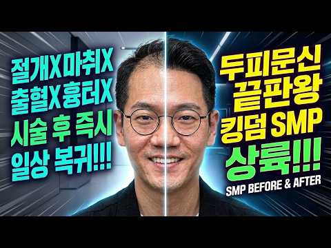 "가발·흑채와 영원한 작별"… 두피문신 전문 ‘킹덤 SMP’, 둘루스에 상륙 #애틀랜타 #라디오코리아 #SMP
