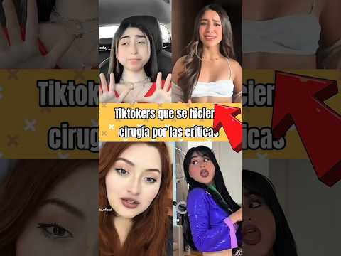 Tiktokers que recurrieron a cirugías por las criticas