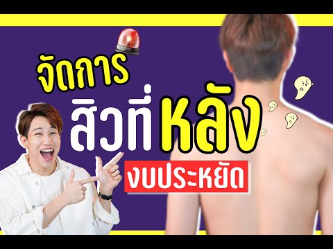 รักษาสิวที่หลัง-สิวหลังหาย-ไม่ รักษาสิวที่หลัง-สิวหลังหาย-ไม่