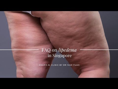 FAQ on lipedema in Singapore | Amaris B. Clinic by Dr Ivan Puah