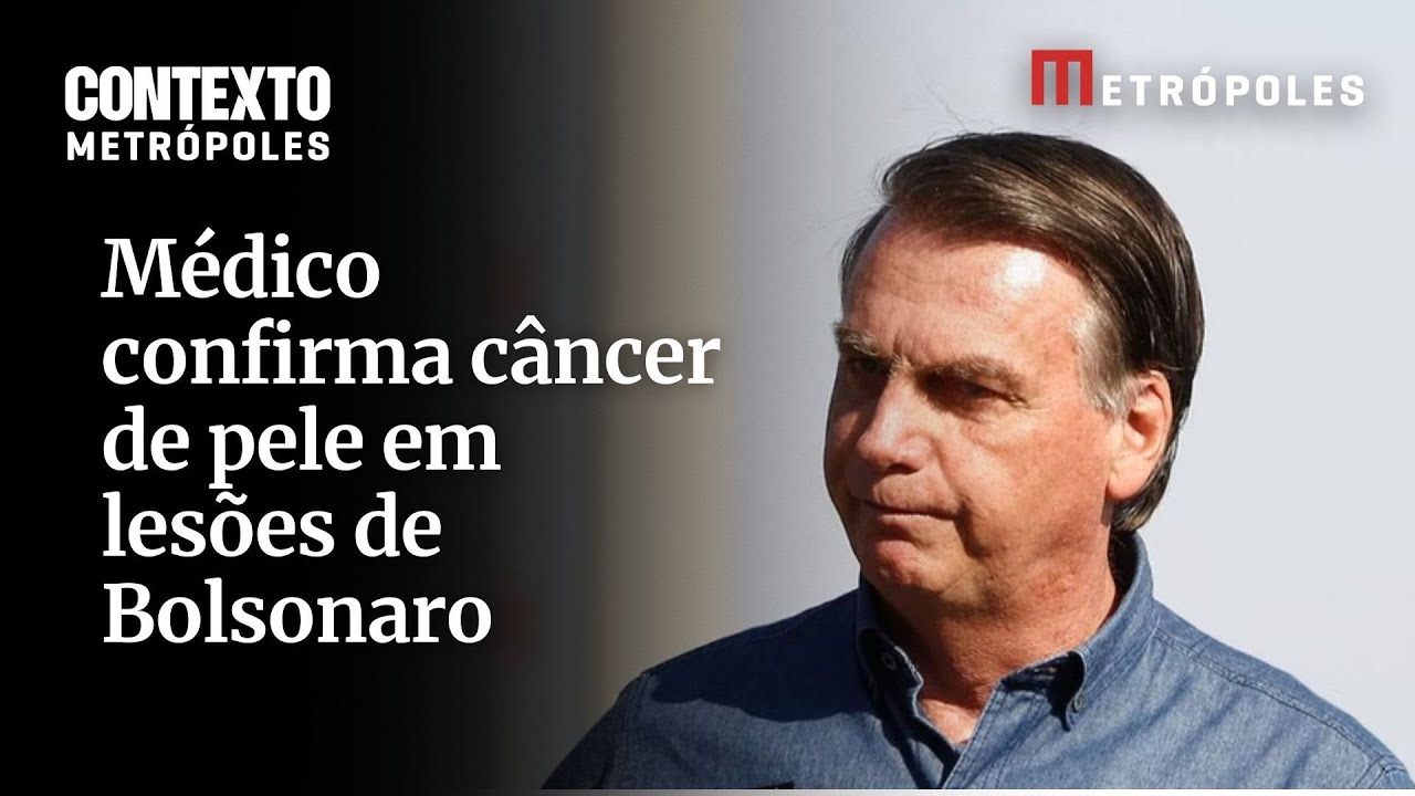 Médico confirma câncer de pele em lesões de Bolsonaro
