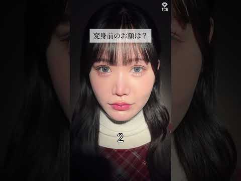 【目頭切開】術前は？
