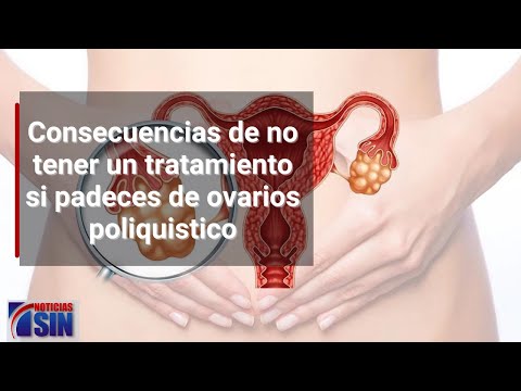 Consecuencias de no tener un tratamiento si padeces de ovarios poliquistico