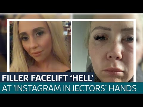 Mum-of-four tells of filler facelift 'hell' at the hands of 'Instagram injectors' | ITV News