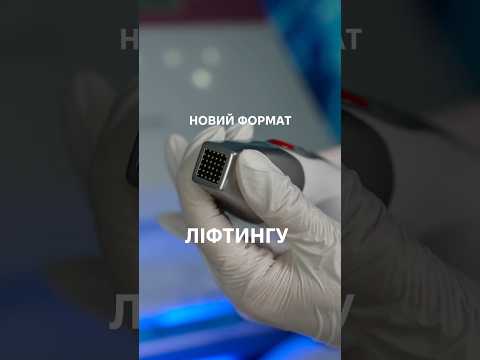 ❄️ Чому варто обрати кріотерапію для своїх клієнтів? ❄️
