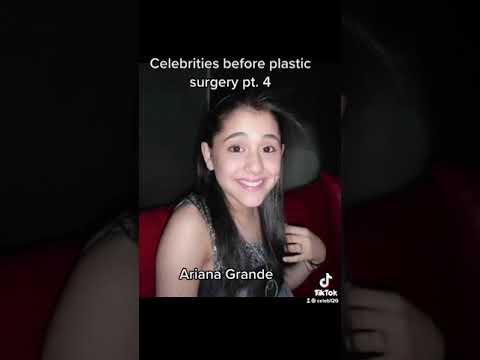ARIANA GRANDE BEFORE PLASTIC SURGERY #shorts