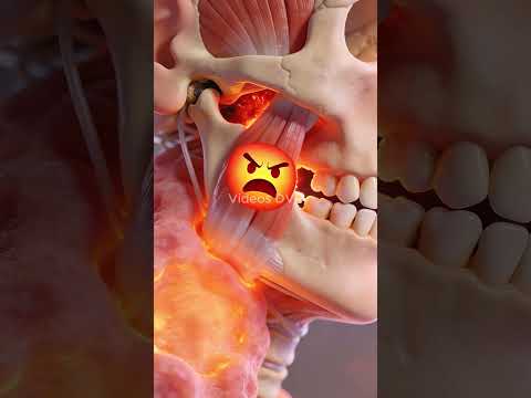 Hola Soy tu Bruxismo