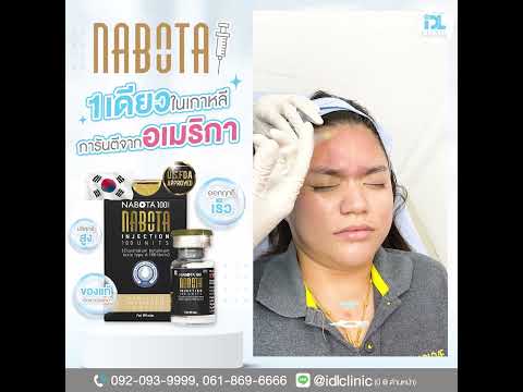 💥รีวิวฉีด𝐁𝐎𝐓𝐎𝐗𝐍𝐀𝐁𝐎𝐓𝐀🌟ปังสุดๆ