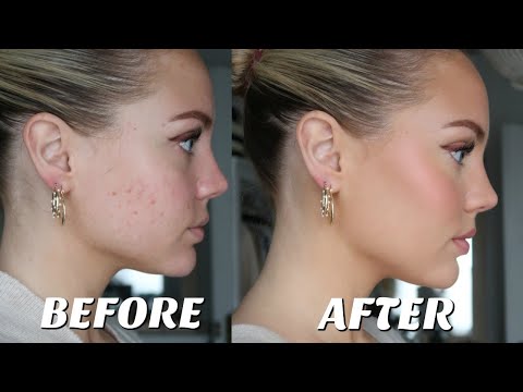 HOW TO COVER ACNE/LONG LASTING MAKEUP || Elanna Pecherle 2020