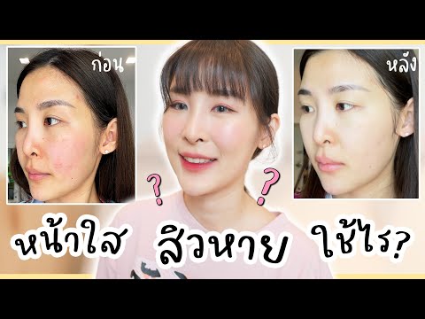7-ไอเท็มหน้าใส-รักษาสิว-ลดจุดด 7-ไอเท็มหน้าใส-รักษาสิว-ลดจุดด