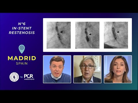 A patient with stent failure – how should I treat in-stent restenosis? – Webinar
