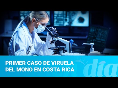 Estadounidense residente en Costa Rica es el primer caso de viruela del mono