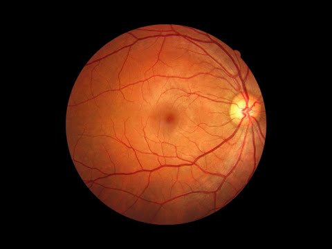 Conozca una nueva técnica que permite la detección de problemas en la retina