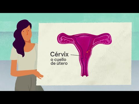 Prevención del cáncer del cuello uterino y vacuna del VPH