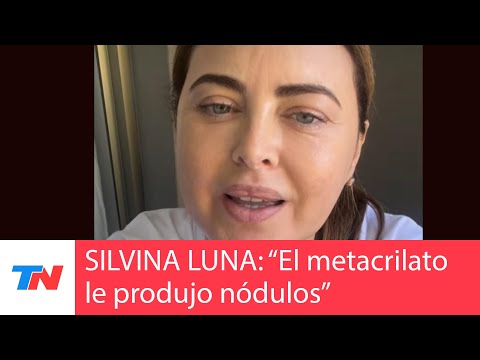 Silvina Luna espera un trasplante I El metacrilato mal administrado le produjo hipercalcemia