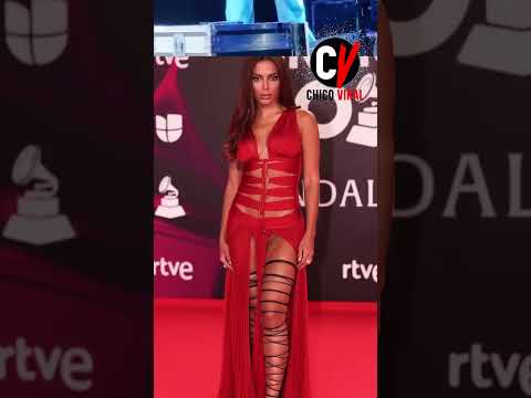 #shorts Este es el defecto de Anitta del que todo el mundo habla #anitta