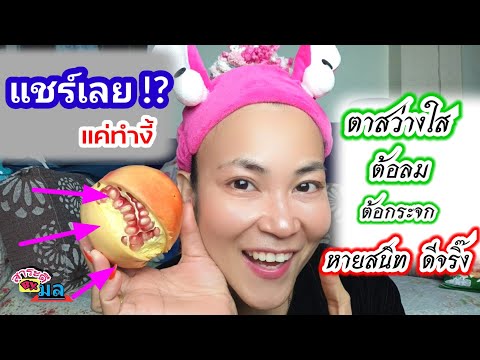 ต้อลม-ต้อกระจก-ต้อหิน-ตาฟางตาม ต้อลม-ต้อกระจก-ต้อหิน-ตาฟางตาม
