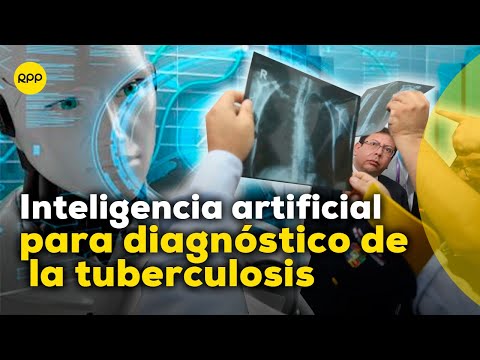 IA para el diagnóstico de tuberculosis. ¿Cómo funciona esta inteligencia artificial?