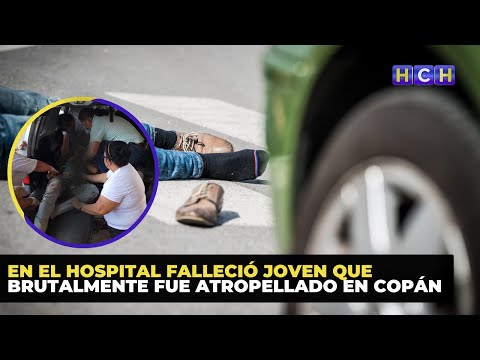En el hospital falleció joven que brutalmente fue atropellado en Copán