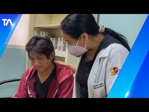 Hospital Baca Ortiz cuenta con clínica de atención integral del paciente fisurado