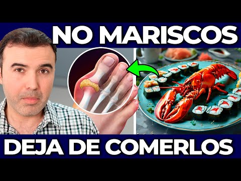 ALERTA! NO DEBES COMER MARISCOS - Contraindicaciones Y Enfermedades Por Comer Frutos De Mar