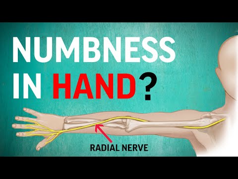 Hand numbness? This radial nerve floss gives fast relief