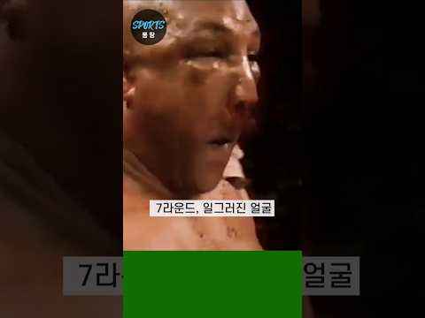 안면 괴물이 된 복싱 영웅 #복싱