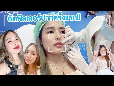 Vlog5พาไปฉีดฟิลเลอร์ปากครั้