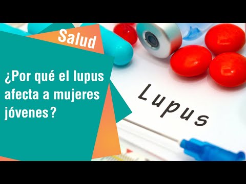 ¿Por qué el lupus afecta mayormente a mujeres jóvenes | Salud