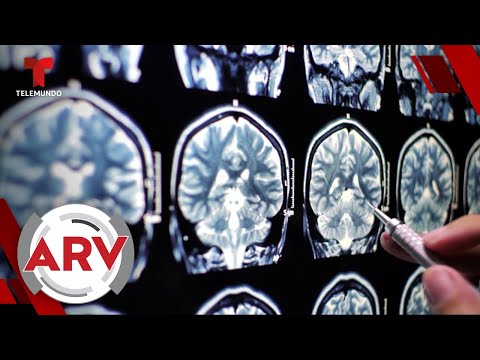 Médico que logró rejuvenecer su cerebro revela cómo lo hizo | Al Rojo Vivo | Telemundo