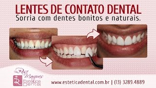 Dra. Rose Marques fala sobre lentes de contato dental no Baile Oficial da Cidade de Santos 2016 - Onnigumo Show