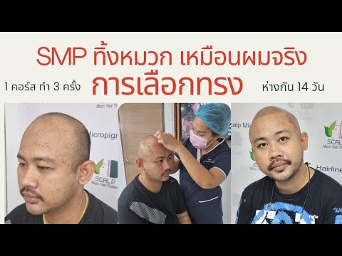 การเลือกทรงก่อนทำSMPทิ้งหม