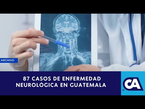 Guatemala reporta 87 casos Guillain Barré según última actualización del Ministerio de Salud