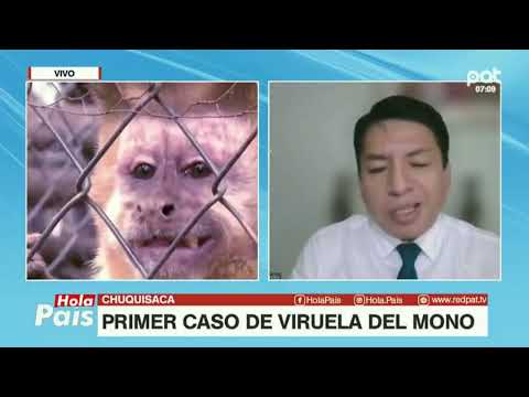 PRIMER CASO DE VIRUELA DEL MONO EN CHUQUISACA
