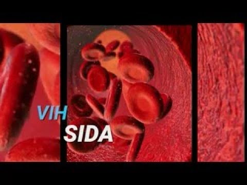 VIH Sida