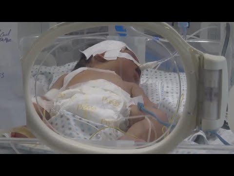 Gaza maternity ward team struggling amid increase in number of premature births