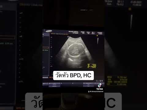 27weekspregnancyคนท้องdrno