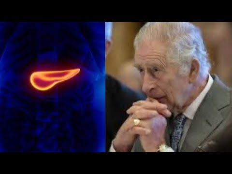 Charles III face au cancer du pancréas, les médecins lui donne deux ans à vivre